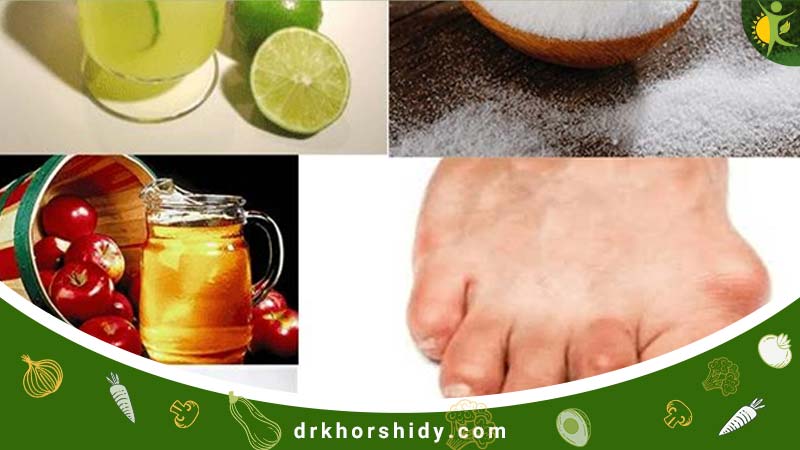 نشانه های دیابت در پای یک فرد و در کنار آن لیمو و عسل