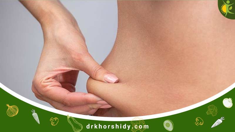 فردی که پهلوی خود را گرفته به نشانه چاقی